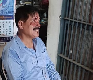 नायब तहसीलदार पर ग्रामीणों ने बोला हमला, गांव में तनाव बढ़ा Villagers attacked the Naib Tehsildar, tension increased in the village