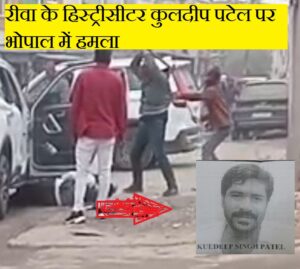 रीवा के हिस्ट्रीसीटर कुलदीप पटेल पर भोपाल में जानलेवा हमला, हालत गंभीर