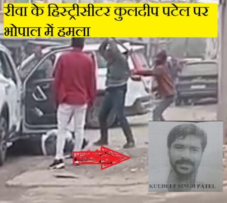 रीवा के हिस्ट्रीसीटर कुलदीप पटेल पर भोपाल में जानलेवा हमला, हालत गंभीर